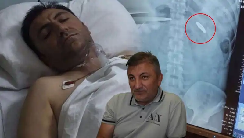 15 Temmuz'un Unutulmaz İzleri: Kurşun Yarası ile Yaşamak