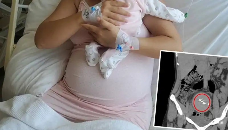 Doğumda Unutulan Bebek: Hastanedeki Gazlı Bez İhmalinin Ardındaki Sır
