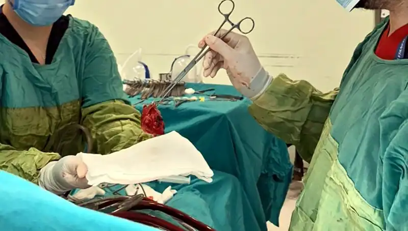 Kalp Kapağı Çürümüş Hastanın 7 Saatlik Ameliyatı: Doktorlar "Mucizevi Bir Olay" Diyor