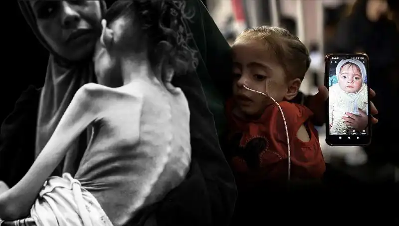 25 Kilodan 10 Kiloya Düşen Meryem: Küçük Yaşında Açlıkla Mücadele Ediyor
